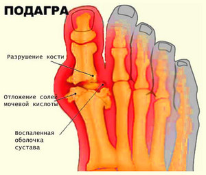 Что модно и что исключить из рациона