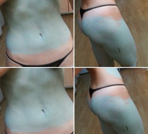 Обгортання блакитною глиною для схуднення та від целюліту: фото до і після, відгуки тих, що худнуть » журнал здоров'я iHealth 4