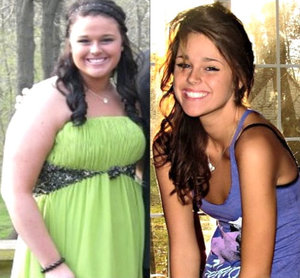 Фото до и после похудения с турбослимом.