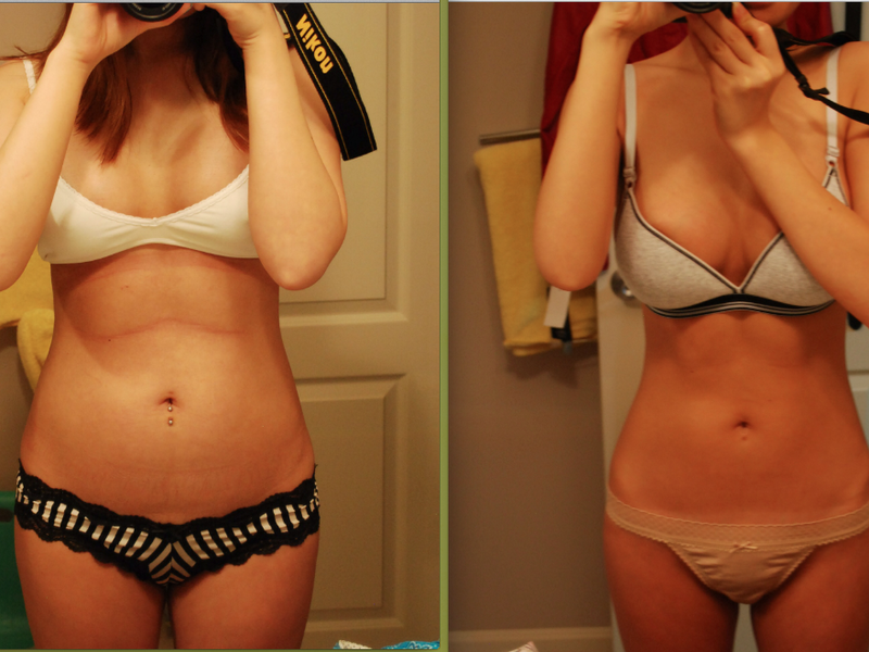 Голодание лечебное  - фото до и после, результаты.